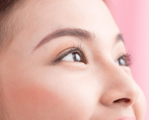 Double eyelid surgery